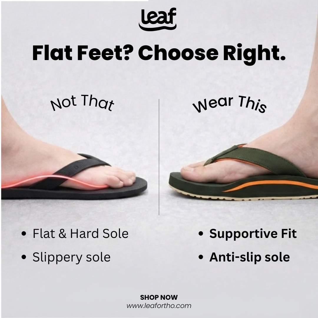 Footwear for Flat Feet: How the Right Pair Can Relieve Pain and Improve Posture